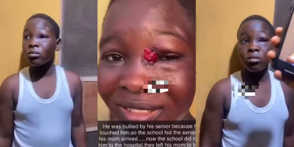 JSS3 student suffers serious injury as senior colleague punches him for touching him with tie (WATCH)